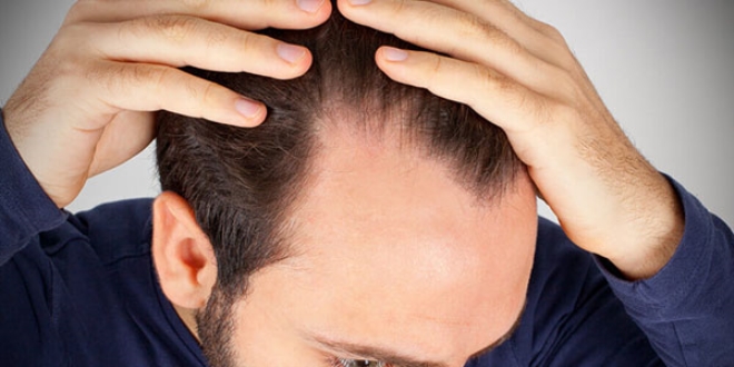 Why is there hair loss?